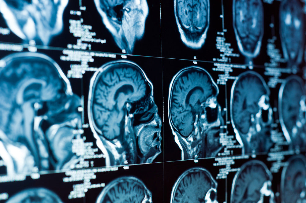 How Do Helmets Mitigate Traumatic Brain Injuries (TBI)?